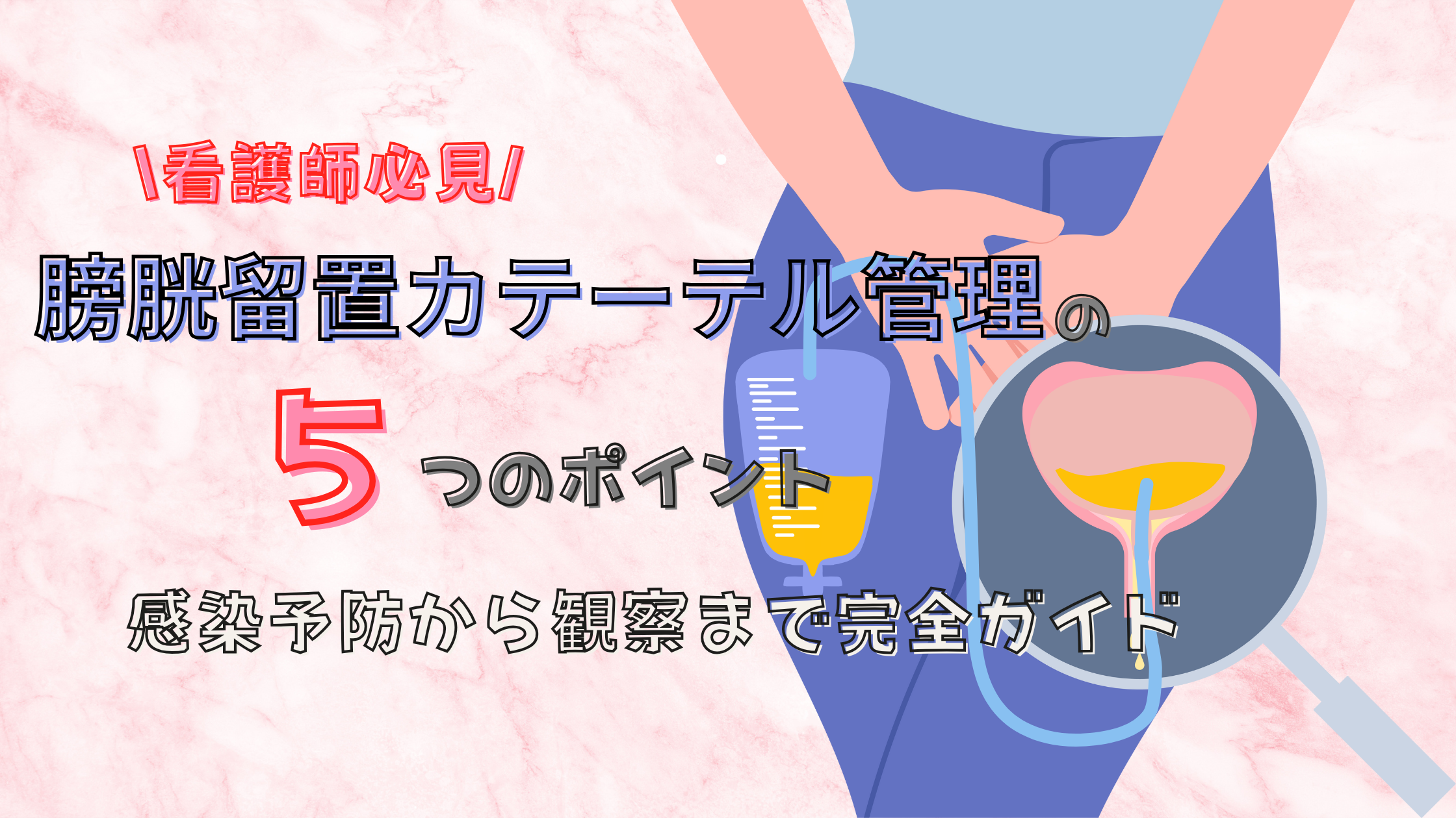 膀胱 瘻 と は
