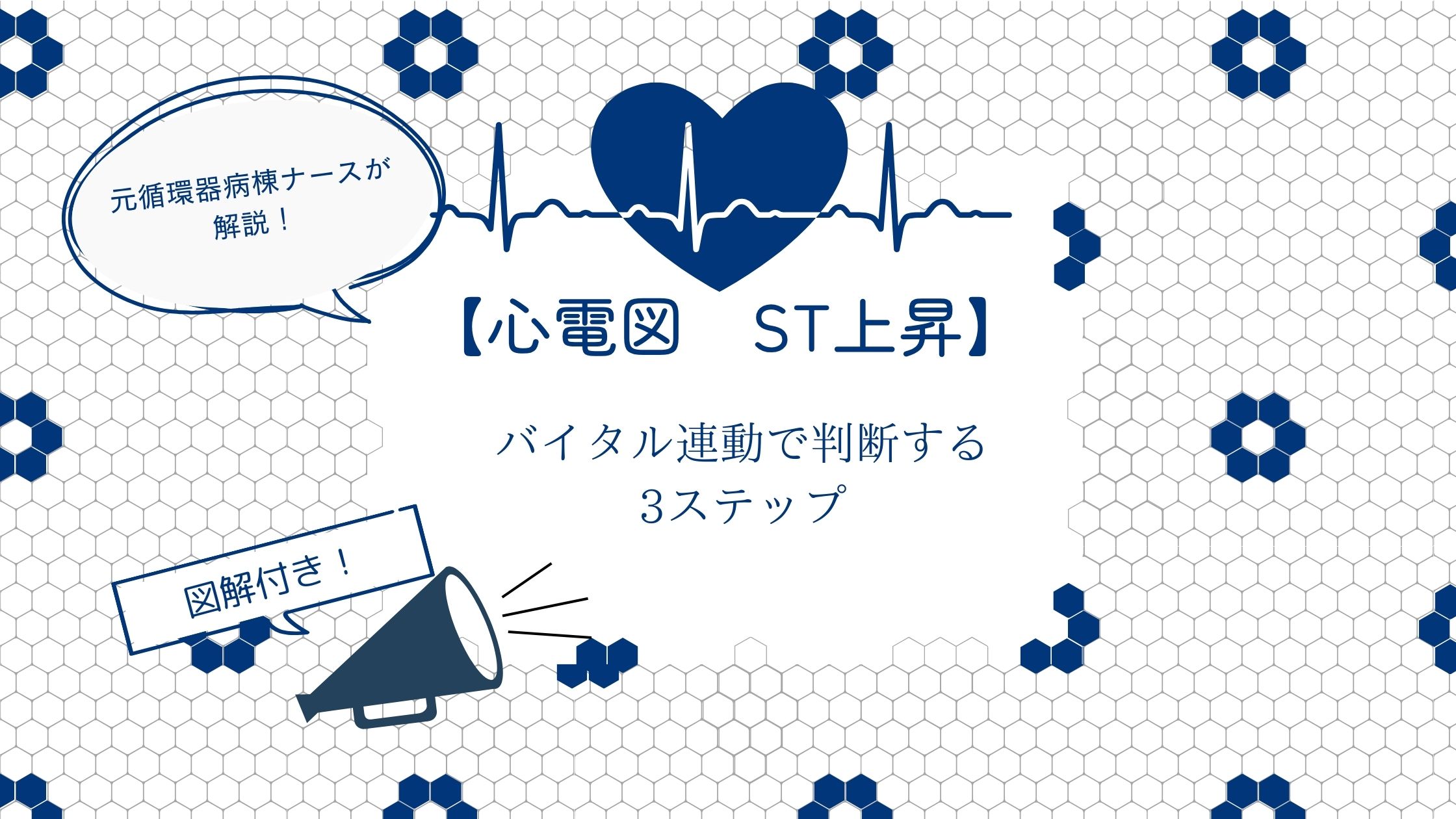 心電図 ST上昇 看護師向け【実践ガイド】バイタル連動で判断する3ステップ