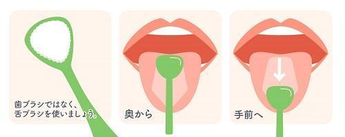 舌苔の除去方法