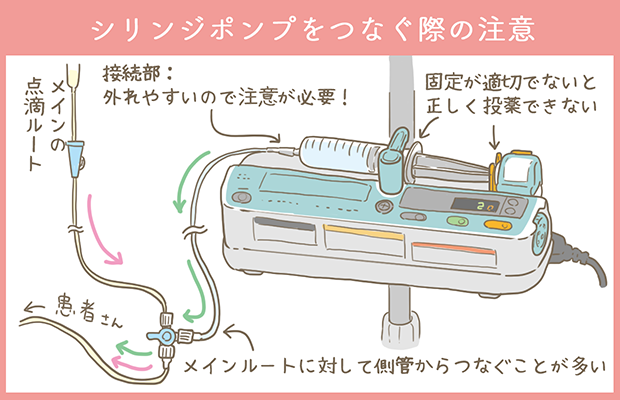 シリンジポンプのセット