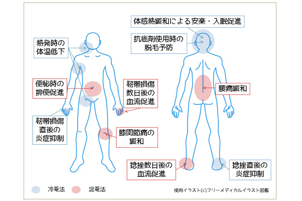 冷罨法と温罨法