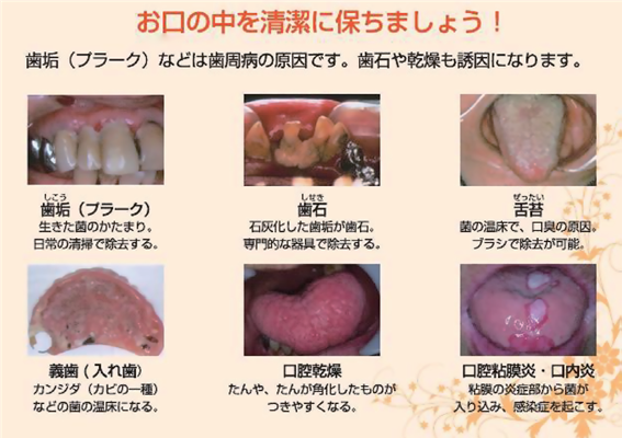 口腔内トラブル