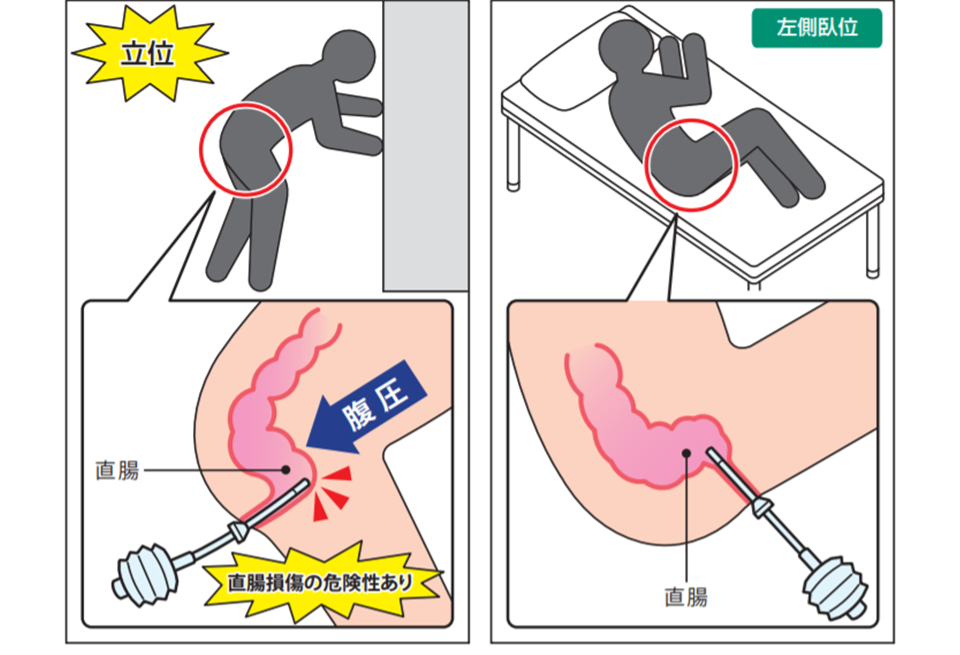 浣腸の注意点