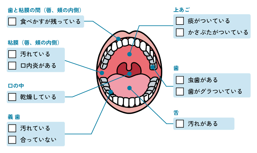 口腔ケア時の観察ポイント
