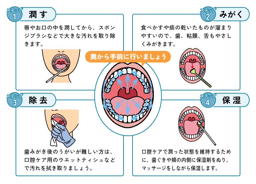 口腔ケアの手順