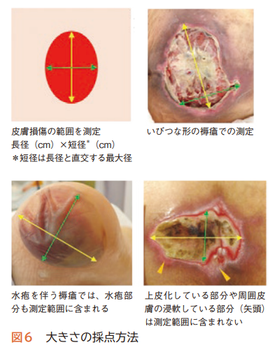 大きさの採点方法