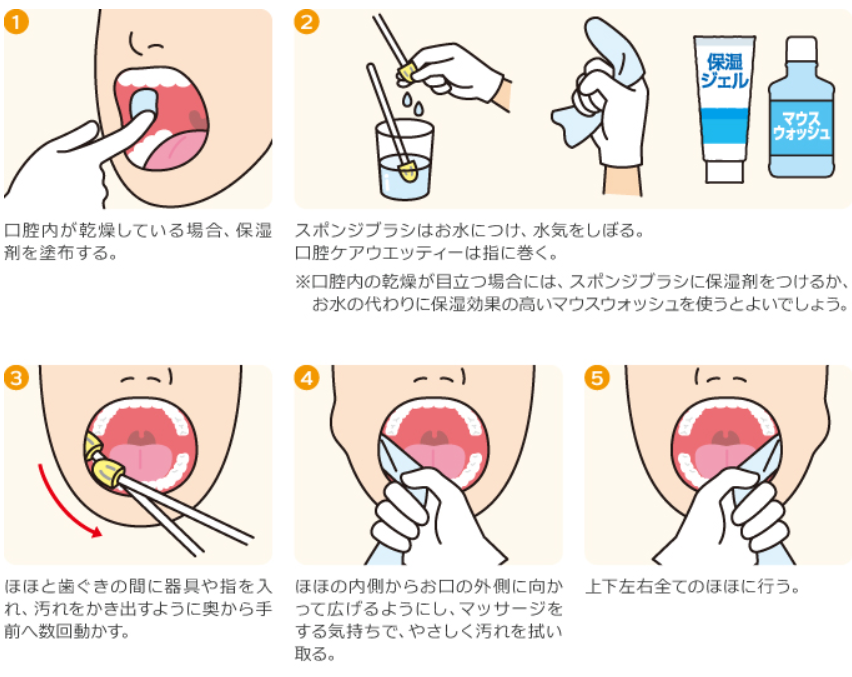 口腔内粘膜ケア