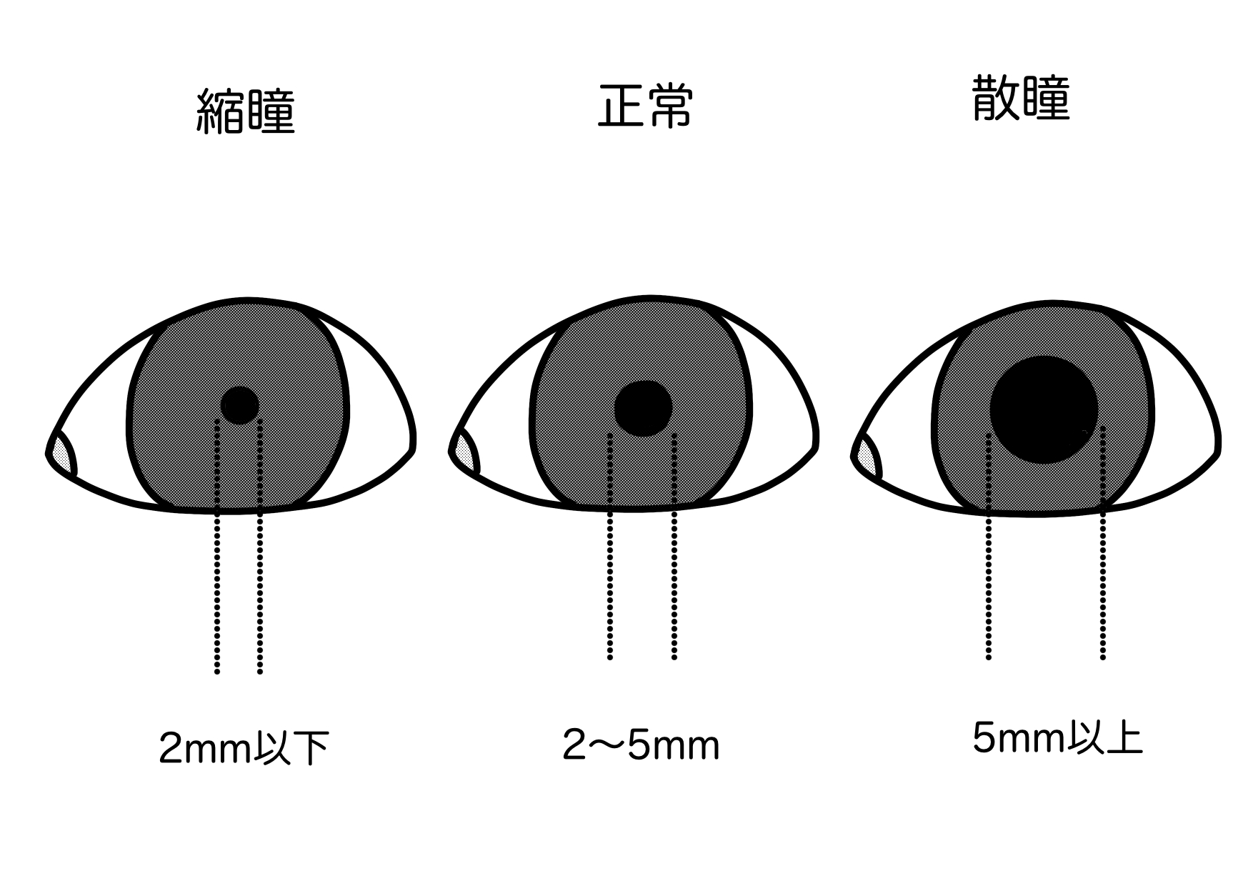 瞳孔観察の極意:初心者でもわかる手順と、見逃せない異常サイン - しごとレトリバーガイド