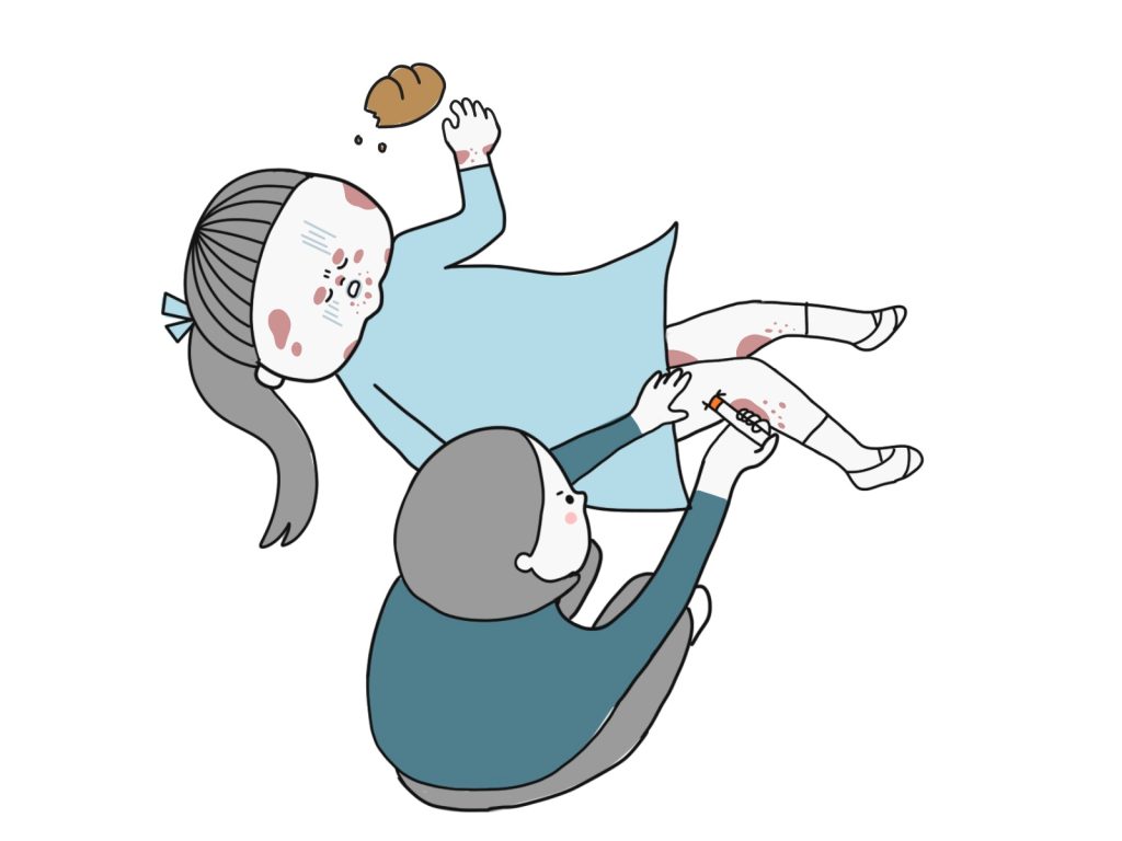 アナフィラキシーショック