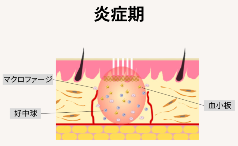 創傷治癒過程の4段階を解説!止血期から成熟期まで - しごとレトリバーガイド
