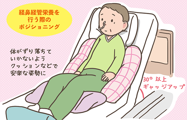 経管栄養の体位