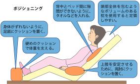 ベッドでのポジショニング