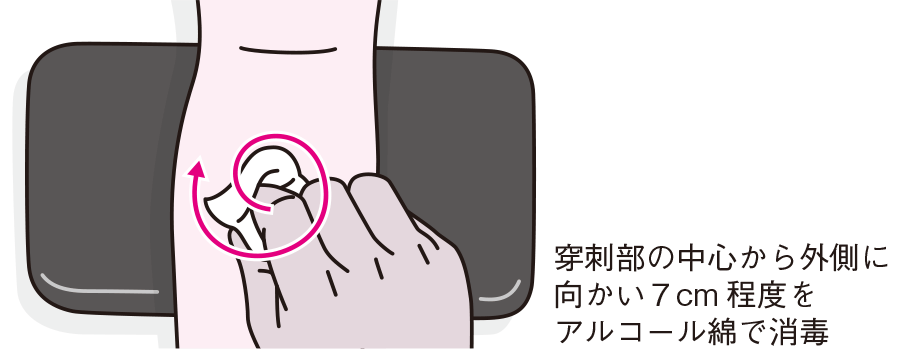 採血時の消毒の方法