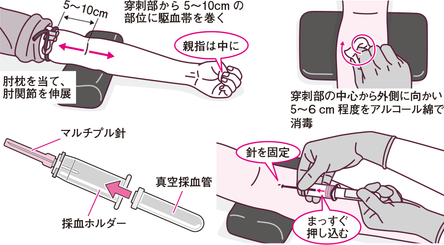 採血の手順