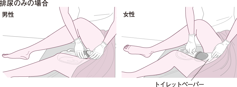 尿器の当て方の解説図