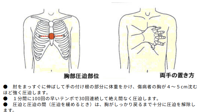 心肺蘇生の手順