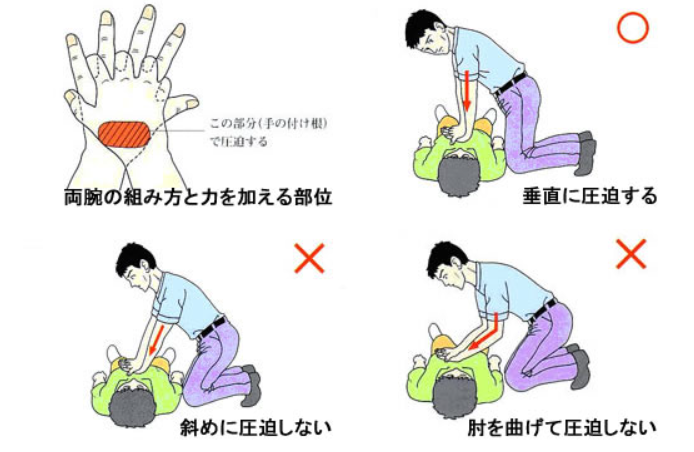 心肺蘇生の手順 