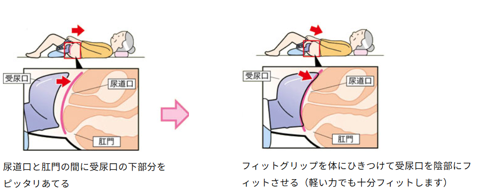 女性の尿器の当て方 