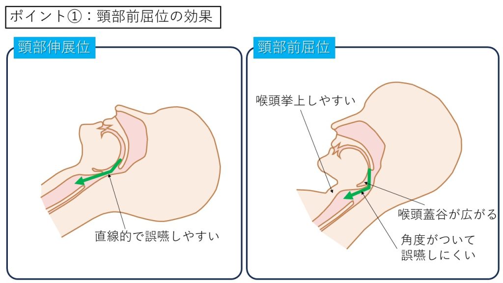 頸部軽度前屈位