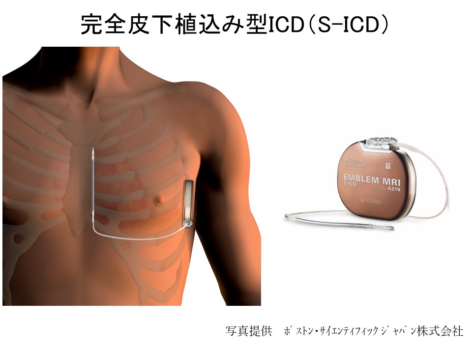 ICDの写真