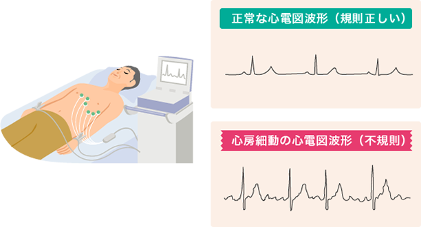 sinnbousaidou ECG af