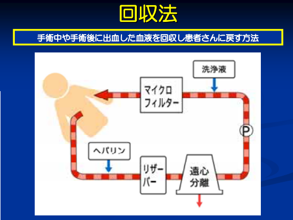  回収法 