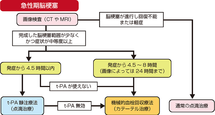 急性期脳梗塞の治療フローチャート