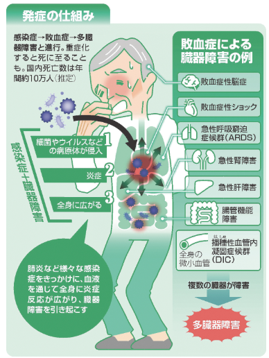 敗血症　症状