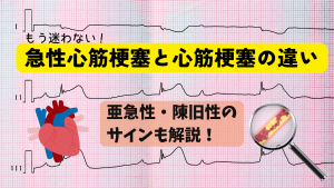 もう迷わない！急性心筋梗塞と心筋梗塞の違い＆見逃しやすい亜急性・陳旧性のサインまとめ🌓
