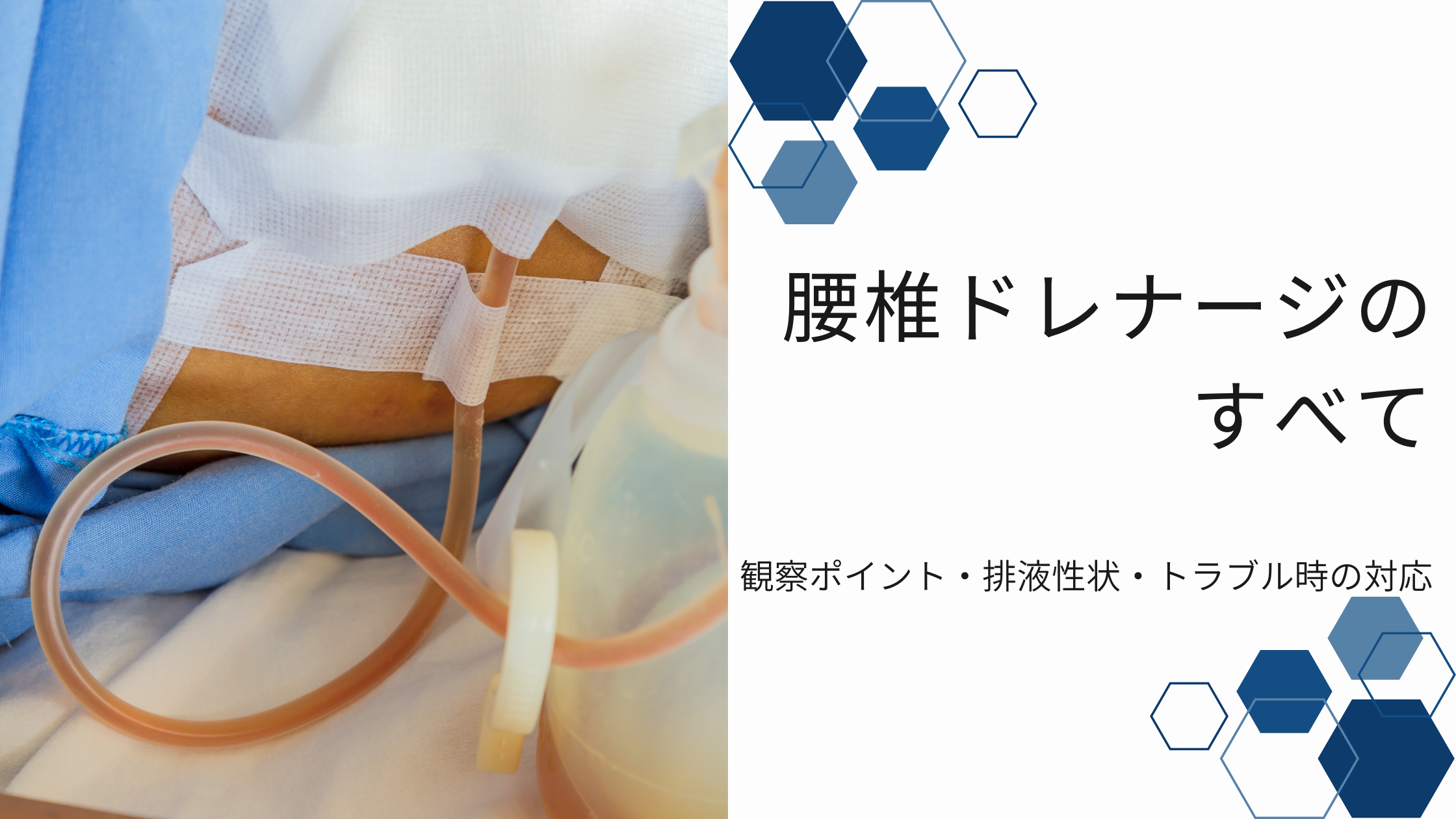 ドレナージ と は