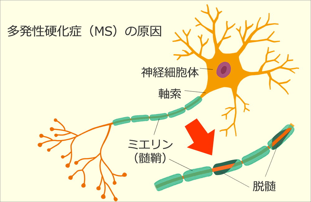 ミリエン
