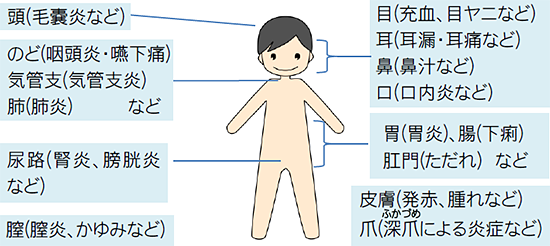 骨髄抑制 症状 観察部位