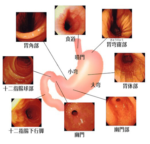 胃カメラ　見え方