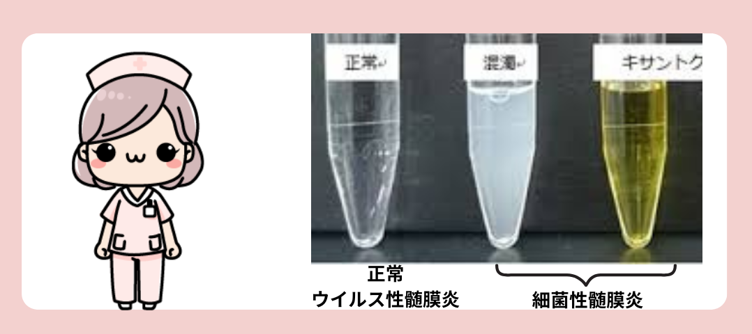 髄液の色　髄膜炎