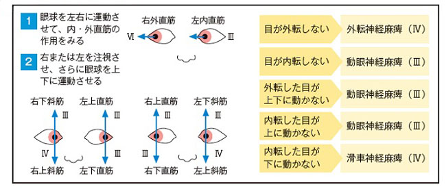 眼球運動の評価