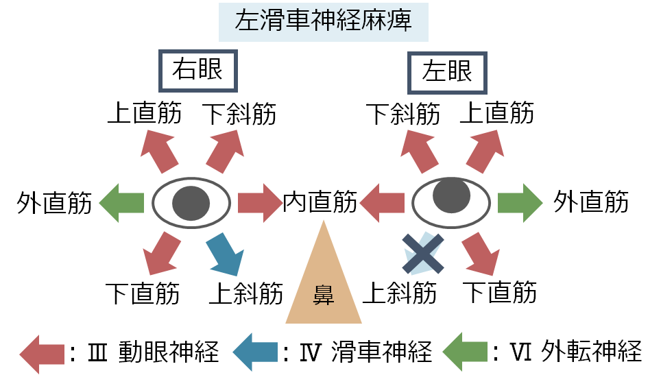 滑車神経