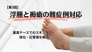 【第3回】浮腫と褥瘡の難症例対応｜重度ケースでのスキンケア・体位・圧管理を解説