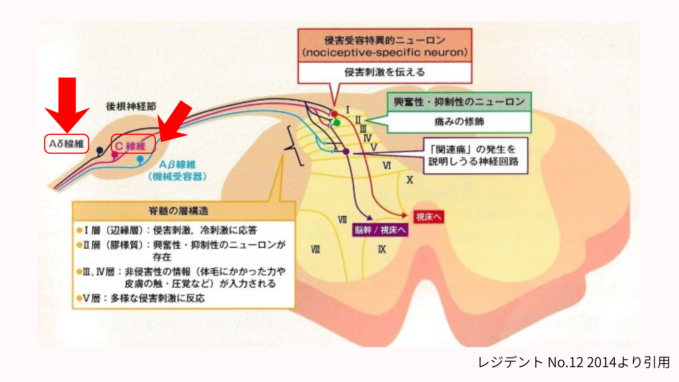 痛覚　神経 Aδ線維（一次痛） C線維（二次痛）