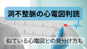 洞不整脈の心電図判読｜様子見と報告の分かれ目を“現場目線”で整理