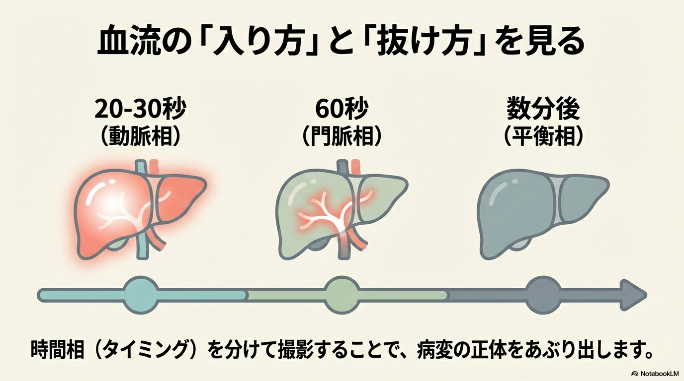 ダイナミックCT