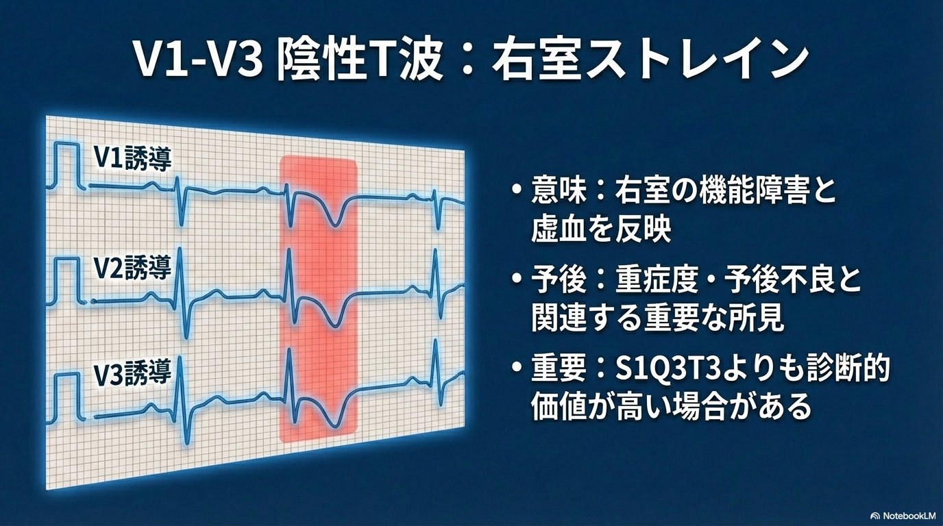 肺塞栓 心電図 右室ストレインパターン