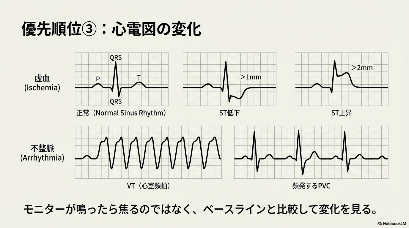 心臓リハビリテーション 心電図
