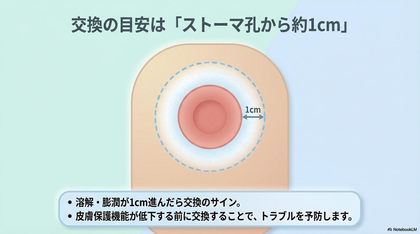 ストーマ　交換目安