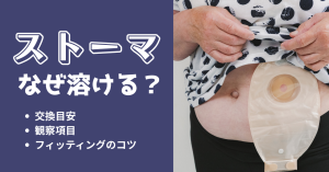 ストーマ面板が溶ける原因は？交換目安と看護判断