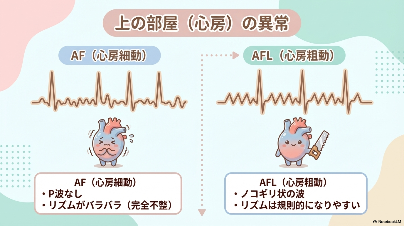 心電図　AF　AFL