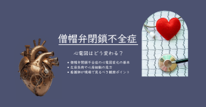 僧帽弁閉鎖不全症の心電図はどう変わる？左房負荷とAfを看護視点で解説